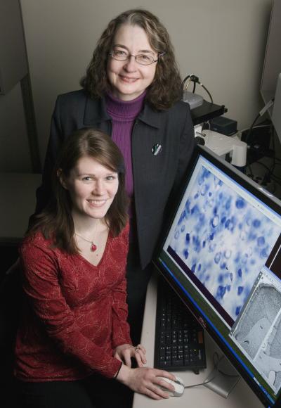 Prefrontal Cortex Loses Neurons During Adolescence