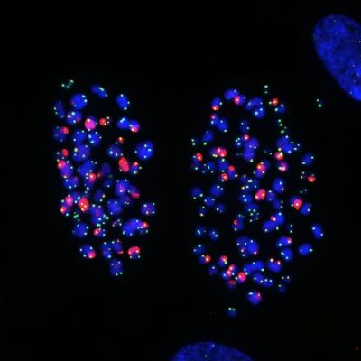 Sending Out an SOS: How Telomeres Incriminate Cells That Can't Divide