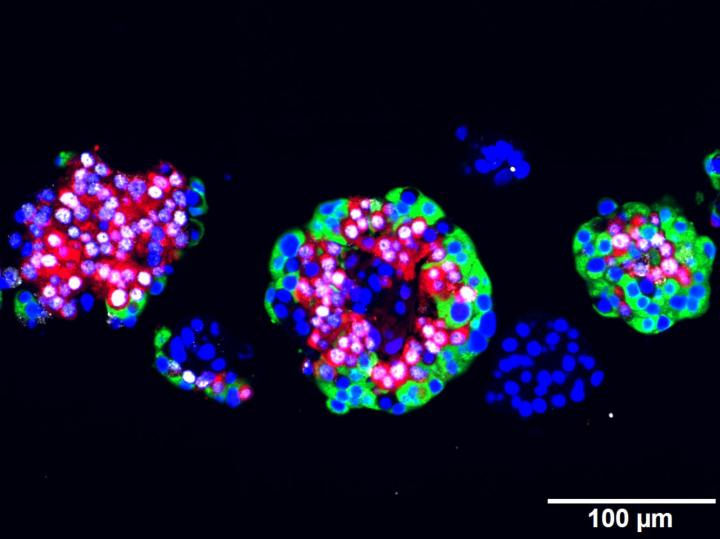 Human Islets of Langerhans