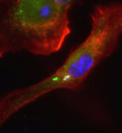 GBps Proteins Kill Bacteria With Antimicrobial Sacs (2 of 4)