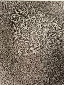 Electron micrograph of E. coli attacking bladder cell