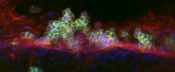 Large Cluster of Hematopoietic Stem Cells and Progenitor Cells