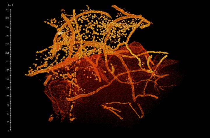 Three-Dimensional Reconstruction