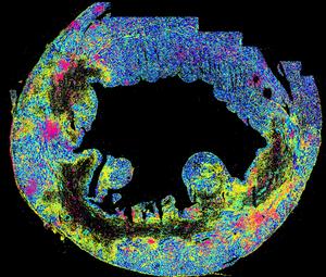 Clustered IFN responses (pink) at the borderzone of an infarcted heart