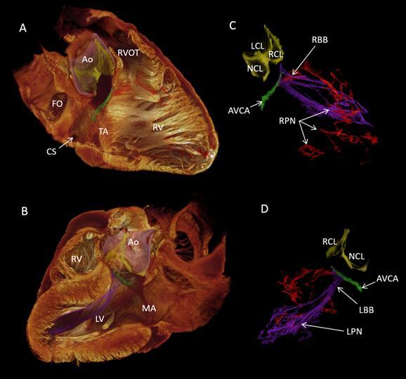 Heart Scan