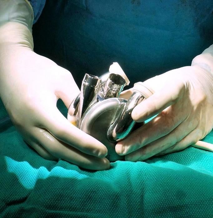 BiVACOR Total Artificial Heart