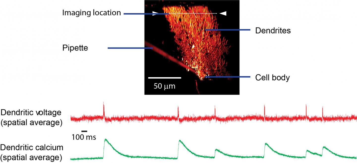 A Purkinje Neuron Labeled with a Voltage-sensitive Dye