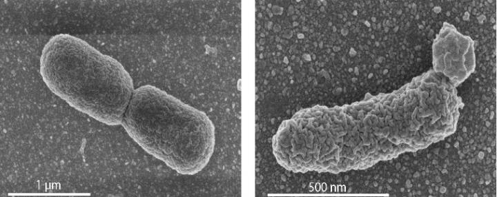Normal and Engineered <i>E. coli</i>, Effect of High Archaeal Lipid Production