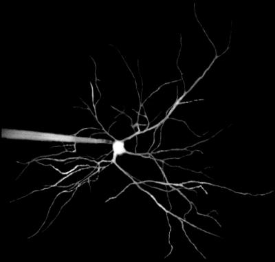 Single Neuron in a Living Brain