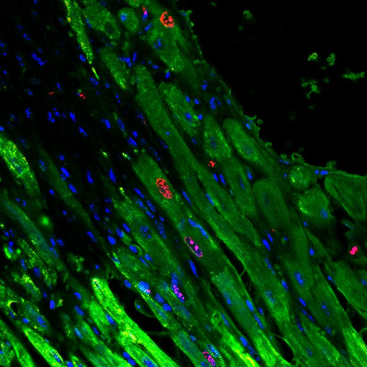 Cardiomyocytes Proliferating
