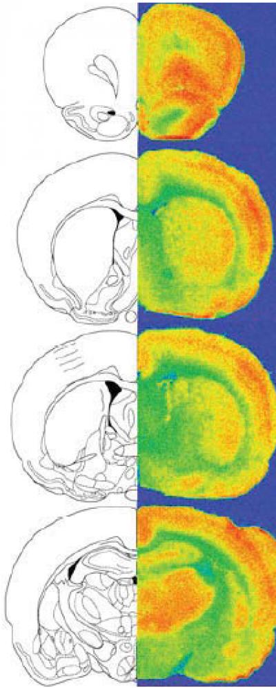 Stress on Young Brain