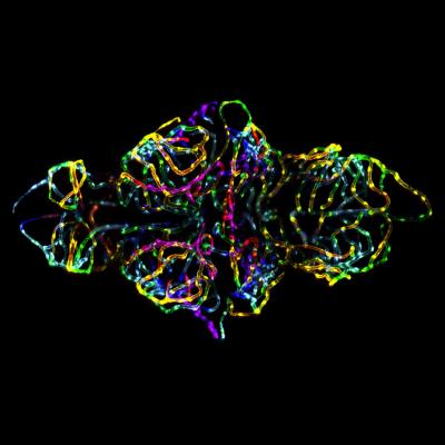 St. Jude Children's Research Hospital Image of Blood-Brain Barrier Wins Photo Competition