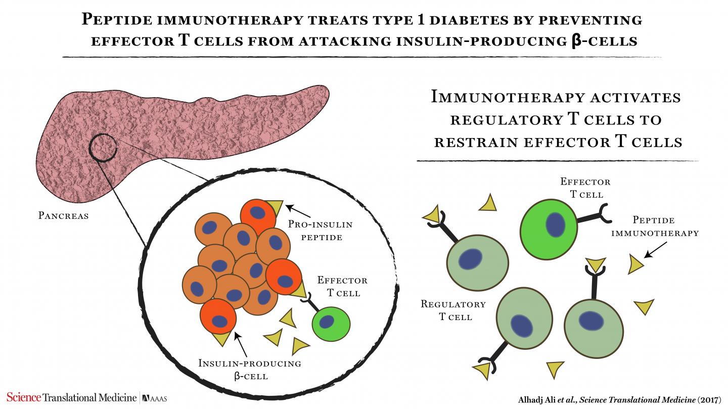 Immunotherapy Shown to Be Safe for Diabetes