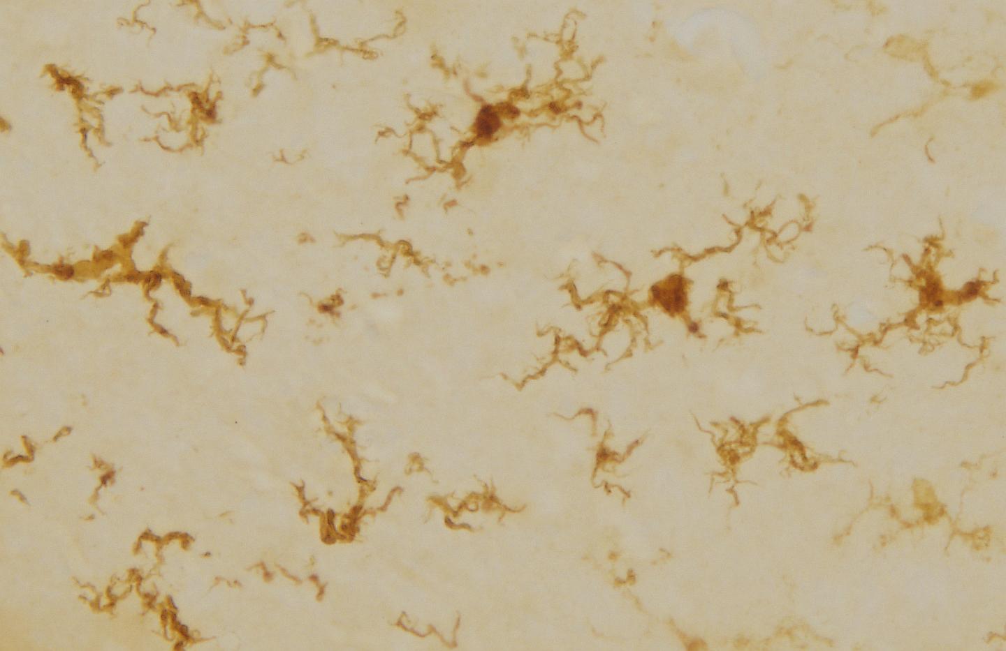 Regenerated Microglia