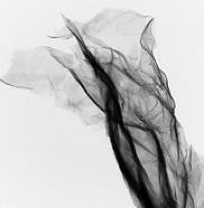 Snapshot of a Partially Re-Opened Nanoscroll