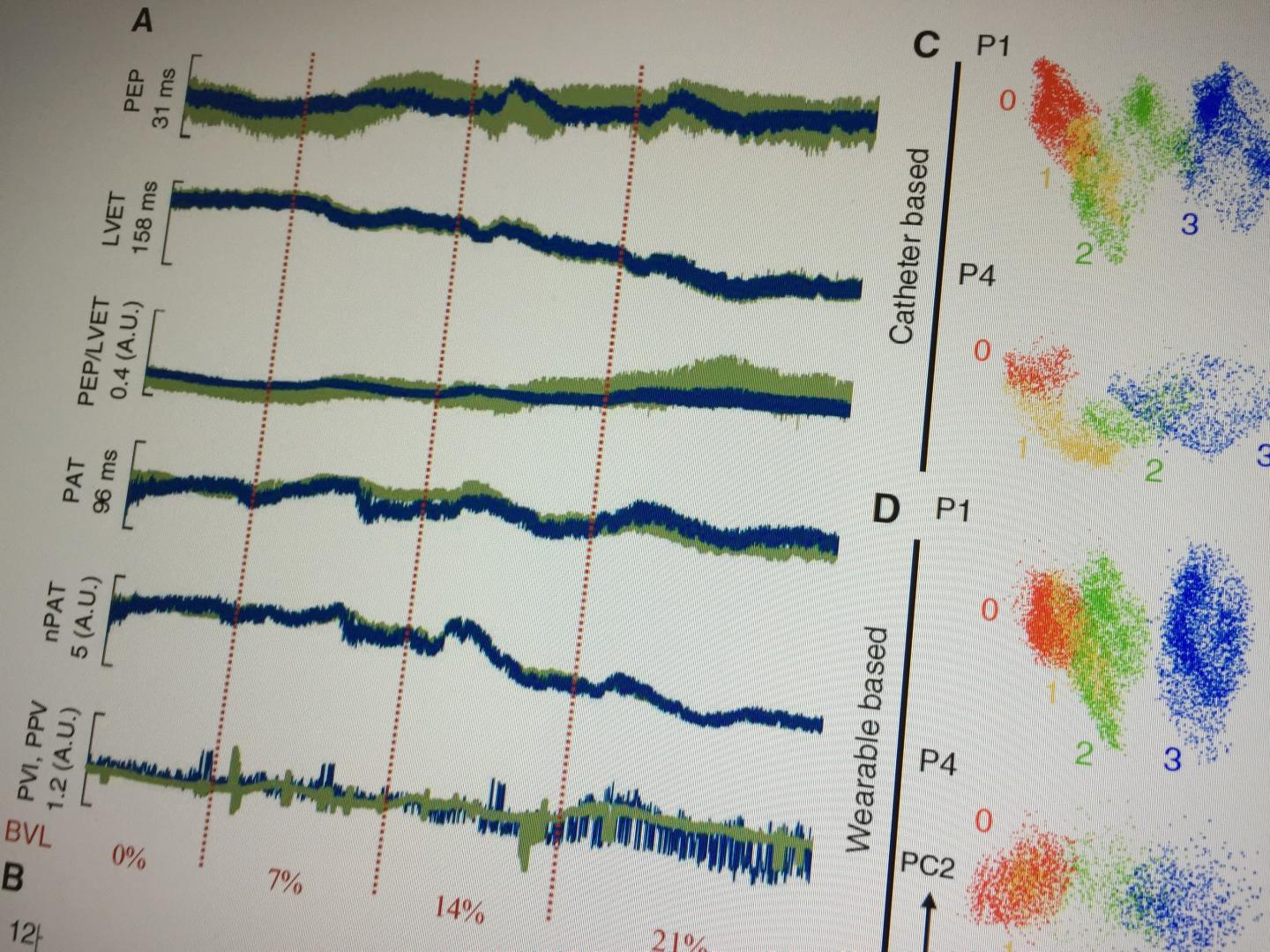 Assessing Blood Loss