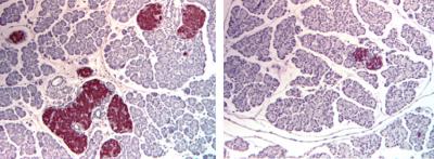 Insulin-Positive Cells in Mice Lacking Leptin-Making Fat Cells