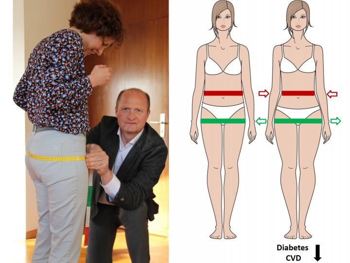 Fat distribution and diabetes