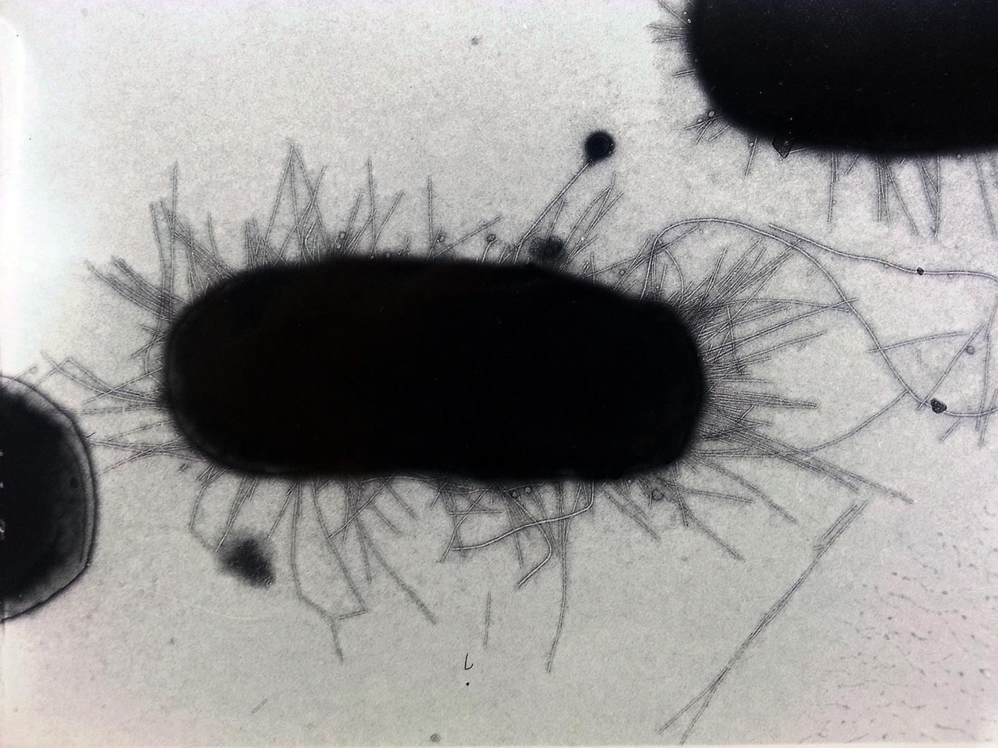 <em>Escherichia Coli</em>