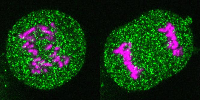 HeLa Cell Expressing Fluorescent GEM Particles