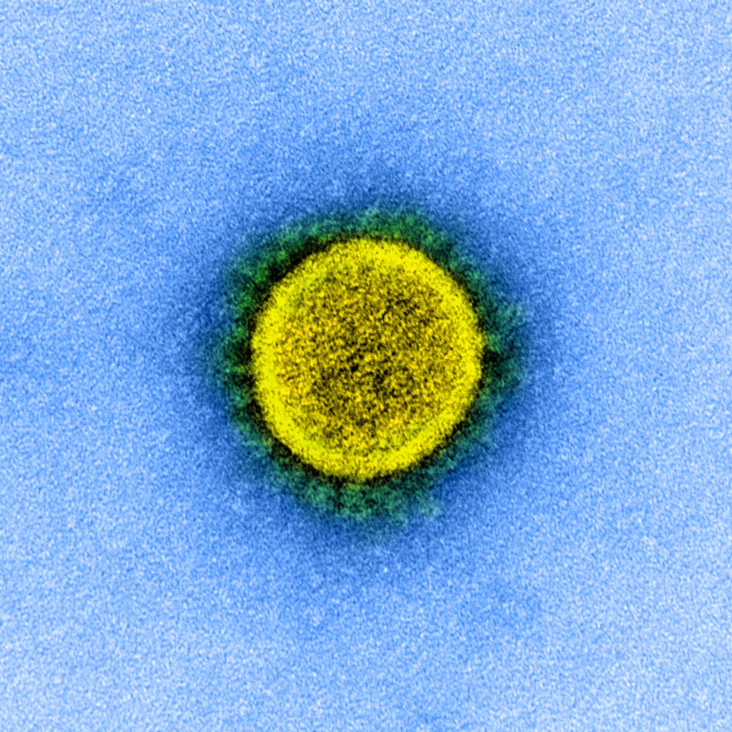 Coronavirus