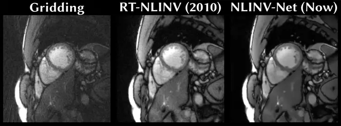 Comparison of the MRI image reconstruction methods