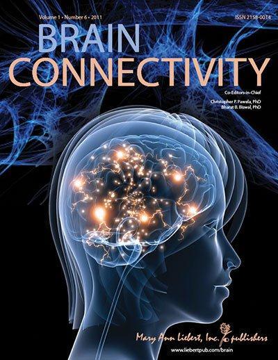 <i>Brain Connectivity </i>