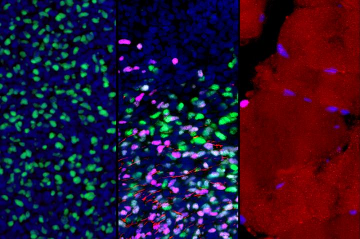 Muscle Stem and Progenitor Cells