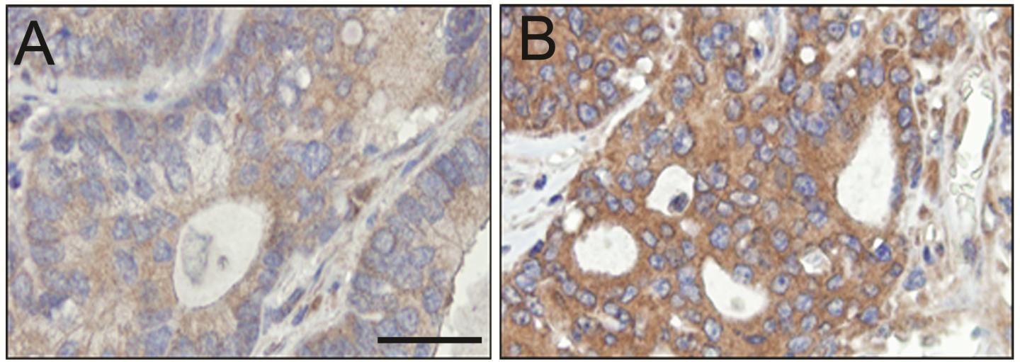 Colorectal Samples Showing PAT4