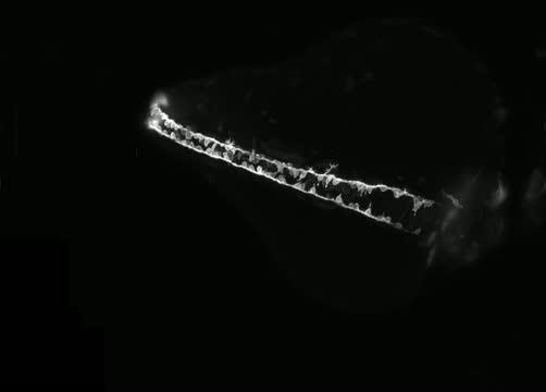 Neuron Development in Zebrafish Embryo: 2018 Nikon Small World in Motion Winner