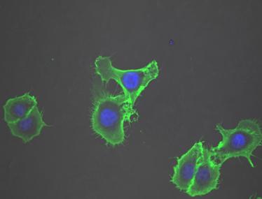 Epithelial Cells