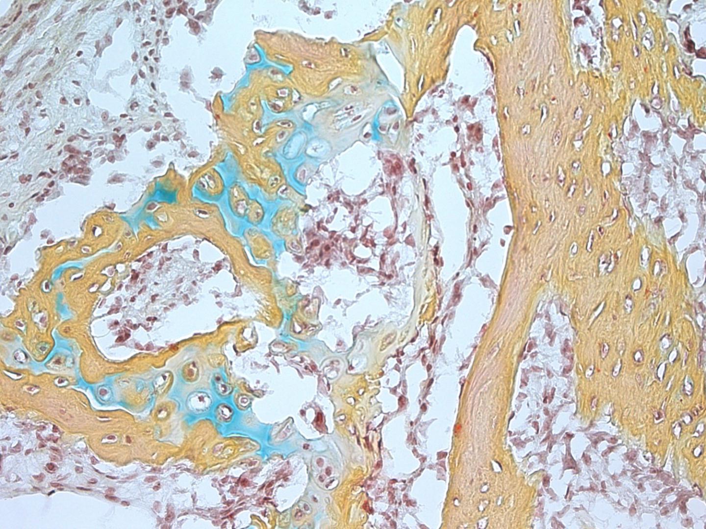 Human Skeletal Stem Cell-Derived Ossicle