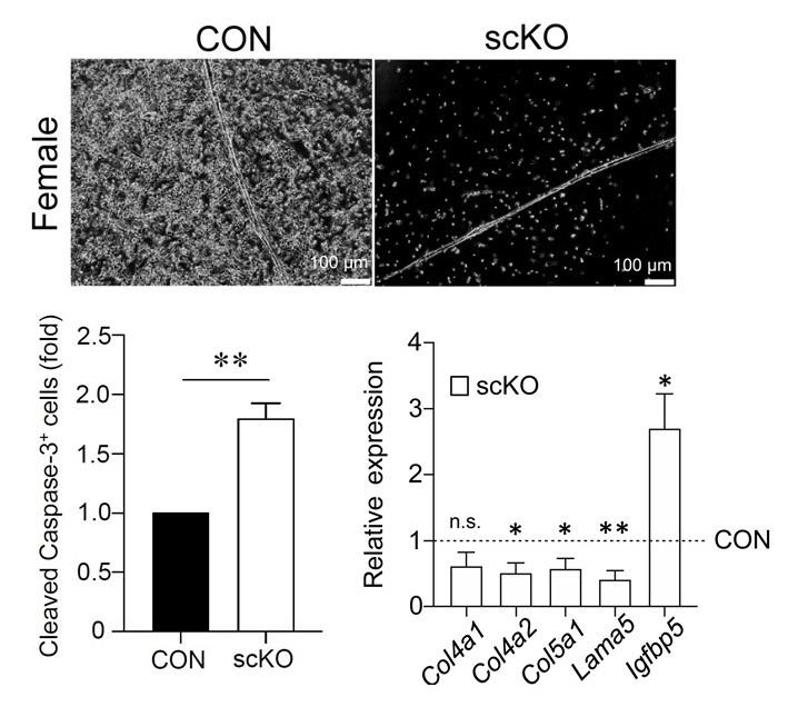 Muscle stem cells lacking ERβ have decreased proliferation and increased cell death