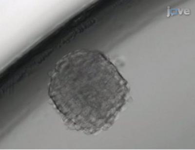 Cultured Neurospheres