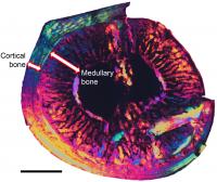 Cross Section of the Femur Bone Viewed Under Polarized Light Showing the Thick Layer of Medullary