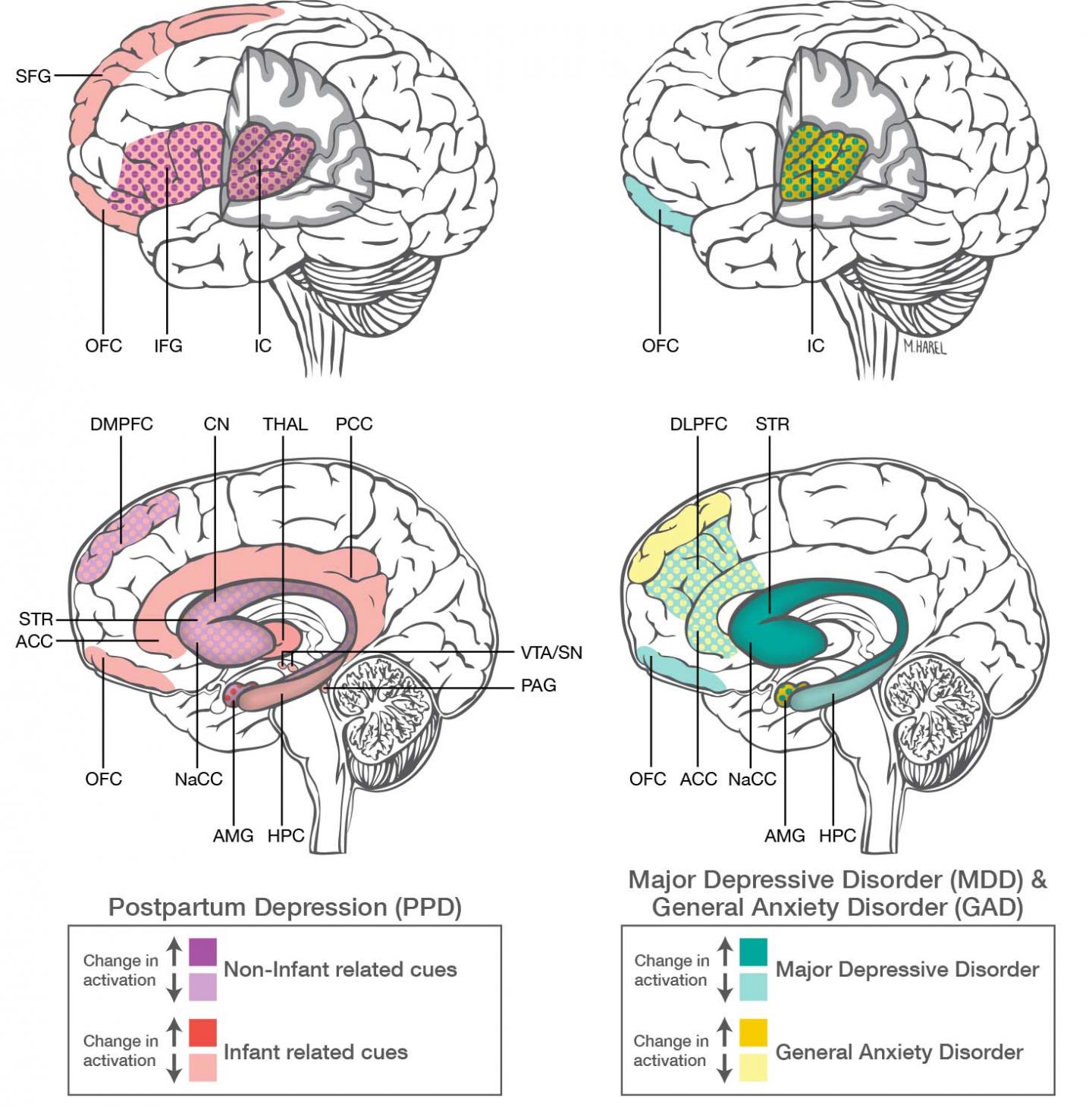 postpartum-psychosis-why-loving-moms-sometimes-hurt-their-babies