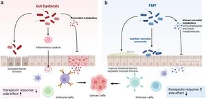 Gut dysbiosis and fecal microbiota transplantation for cancer