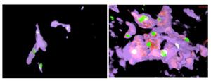 Kupffer cell–like giant cells