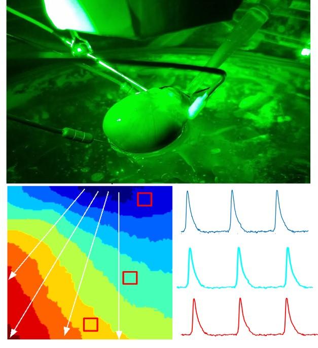 Live, Excised Heart Being Perfused