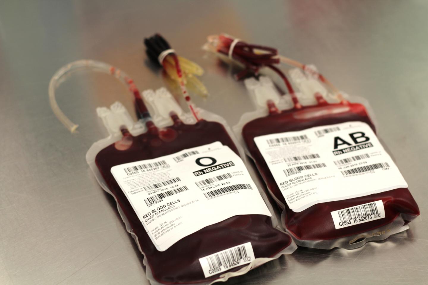 Researchers find association between donor ag eurekalert 