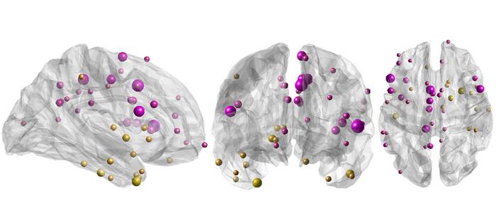 An over- or under-synchronised brain may predict psychosis