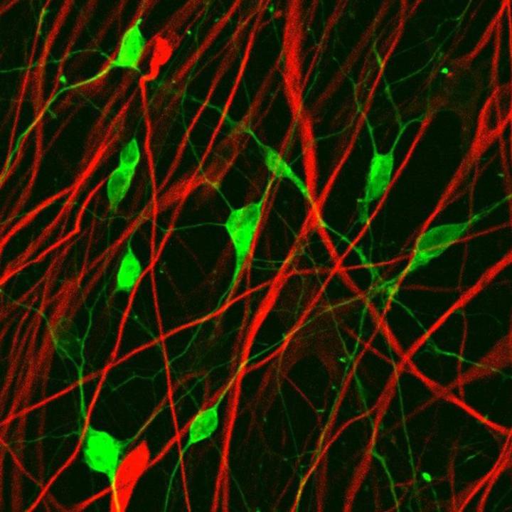 Glioma cell-converted neurons.