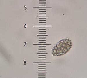 Northern Polyblastia Lichen (Polyblastia hyperborea)