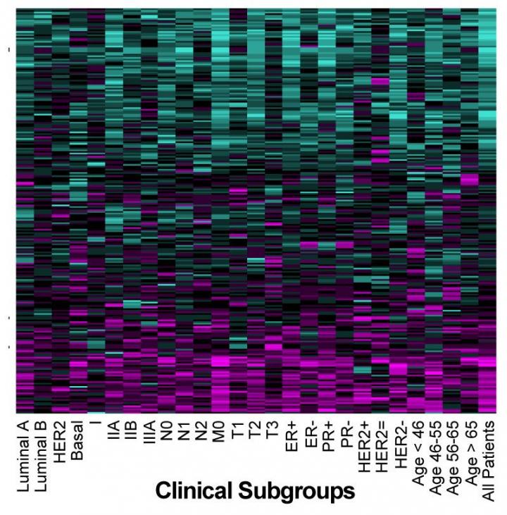 SURVIV Analysis of Breast Cancer Isoforms