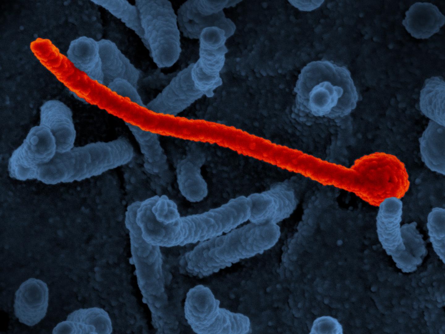 Scanning Electron Micrograph of Ebola Virus Makona from the West African Epidemic Shown on Surface
