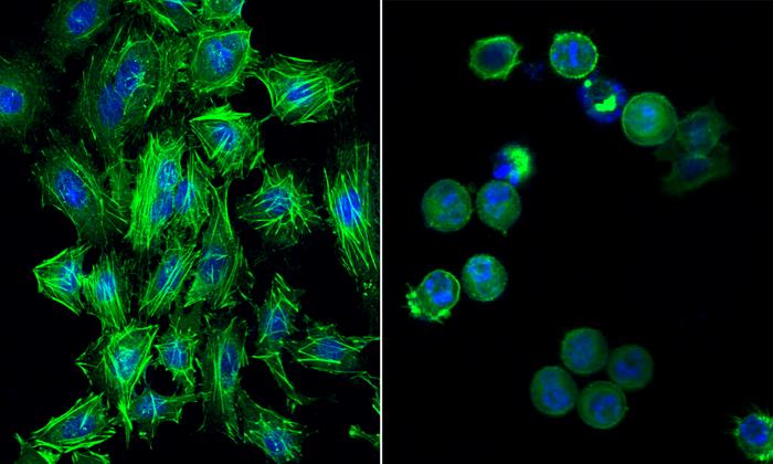 Cervical cancer cells before and after gold drug treatment