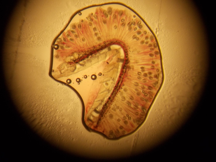 Glochidium larvae