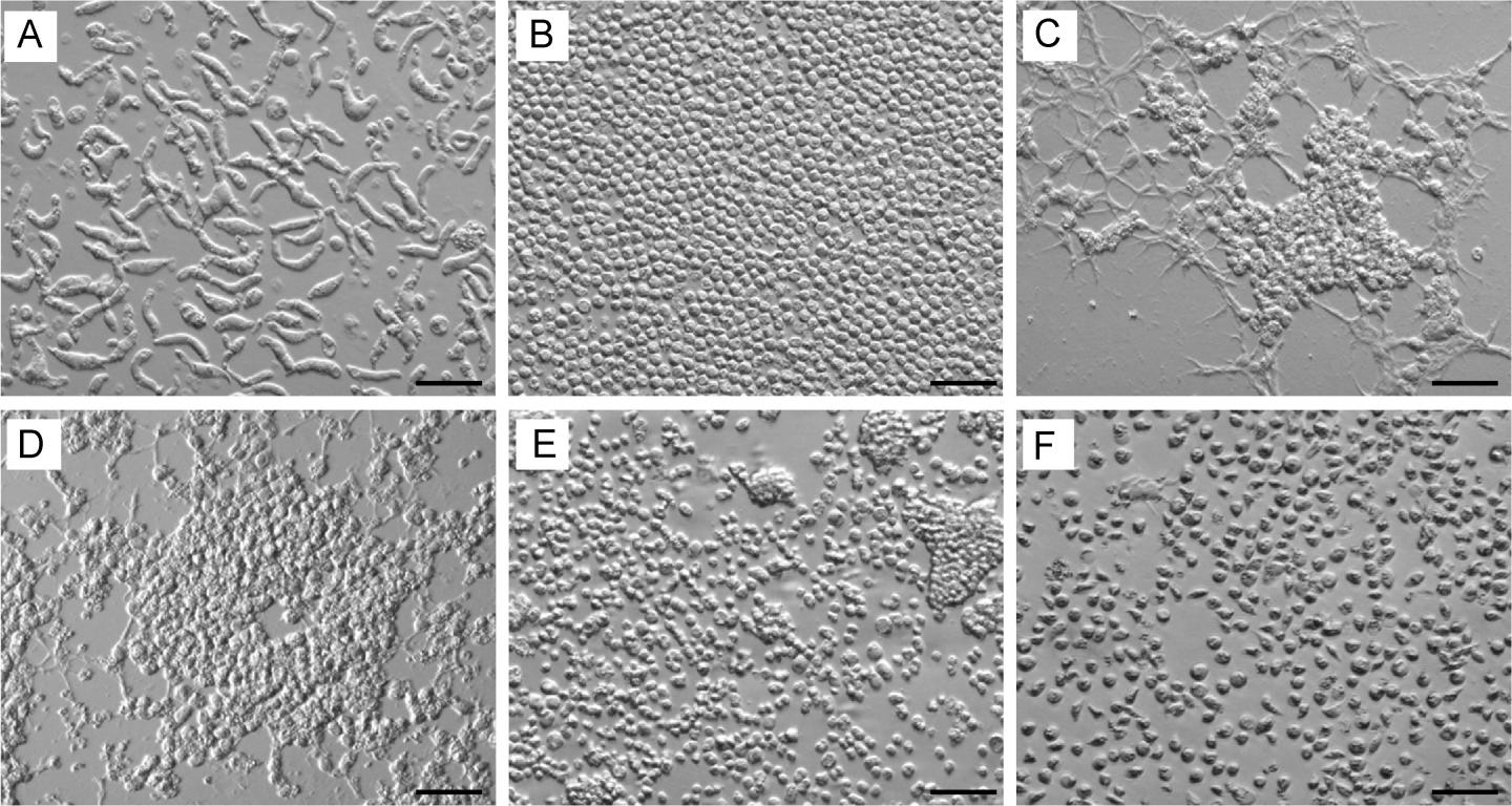 Morphological observation of the in vitro life stages of Hematodinium isolated from the American blue crab, Callinectes sapidus.