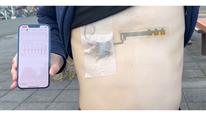 Wireless, wearable, and flexible electrocardiogram monitor with app data