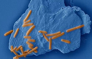 An anaerobic, motile, gram-positive bacterium adheres to the molybdenite (MoS2) surface to uptake the trace elements from the mineral structure for cell synthesis.